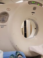 CT scan machine used to take images of area in Alynda's body using x-ray